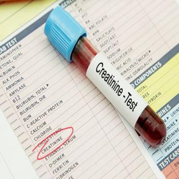 When Do I Need To Worry About My Creatinine